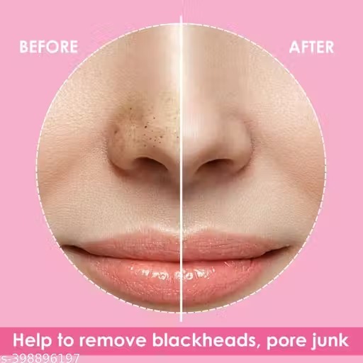 Microfibre Blackhead Remover Strips (Pack Of 10)