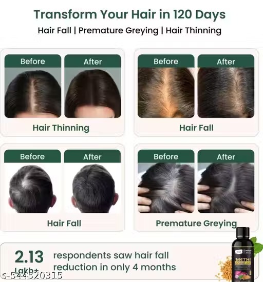 Methi Hair Oil 100ml