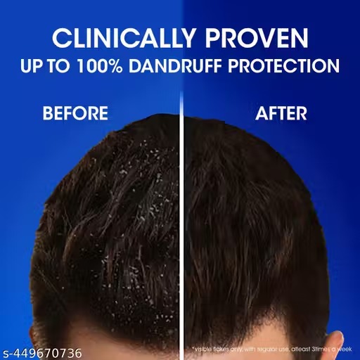 **Head & Shoulders Cool Menthol Shampoo 180ml**